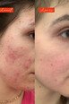 Huile Visage Anti-tâches et Eclat - Sous le Soleil - Cahé